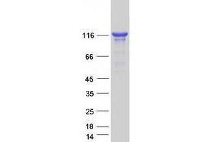 Validation with Western Blot