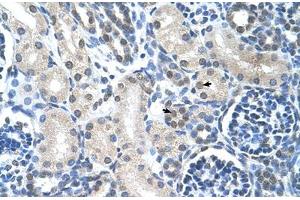 Immunohistochemical staining (Formalin-fixed paraffin-embedded sections) of human kidney with LOR polyclonal antibody . (LOR anticorps  (AA 58-107))