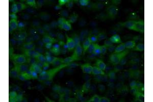 Image no. 9 for anti-Transforming, Acidic Coiled-Coil Containing Protein 3 (TACC3) antibody (ABIN1498097) (TACC3 anticorps)