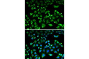 Immunofluorescence analysis of HeLa cell using NHLRC1 antibody. (NHLRC1 anticorps)