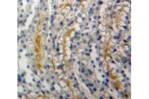 Used in DAB staining on fromalin fixed paraffin-embedded Kidney tissue (ADCY1 anticorps  (AA 303-569))