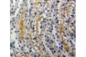 Used in DAB staining on fromalin fixed paraffin-embedded Kidney tissue