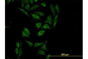Immunofluorescence of monoclonal antibody to HTRA2 on HeLa cell. (HTRA2 anticorps  (AA 359-458))