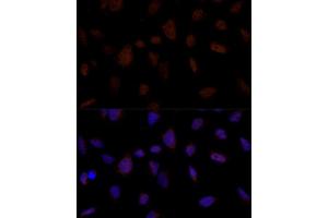 Immunofluorescence analysis of U-2 OS cells using BRE Polyclonal Antibody (ABIN7265912) at dilution of 1:100 (40x lens).