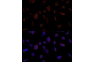 Immunofluorescence analysis of U-2 OS cells using BRE Polyclonal Antibody (ABIN7265912) at dilution of 1:100 (40x lens). (BRE anticorps  (AA 51-229))