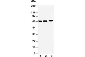 Western blot testing of NUR77 antibody and Lane 1:  A431;  2: HeLa;  3: Jurkat cell lysate (NR4A1 anticorps  (N-Term))