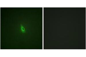 Immunofluorescence analysis of A549 cells, using Inositol 1, 4, 5-trisphosphate R1 (Phospho-Ser1598/1588) Antibody.