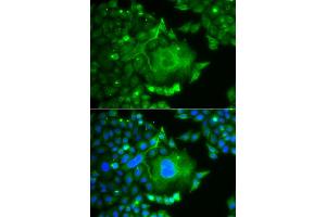 Immunofluorescence analysis of A549 cells using CACNG4 antibody (ABIN6291851).