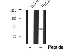 Western blot analysis of DNMT3B expression in HeLa cell lysate (DNMT3B anticorps  (N-Term))