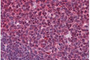 anti-SUMO1/sentrin Specific Peptidase 1 (SENP1) (C-Term) antibody