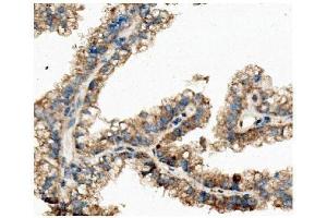 IHC analysis of Ch TOG/CKAP5 using anti-Ch TOG/CKAP5 antibody (ABIN7599106). (CKAP5 anticorps  (AA 1-221))