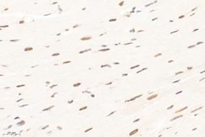 anti-Proteasome 20S LMP2 antibody