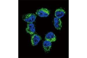 Confocal immunofluorescent analysis of BDNF antibody with NCI-H460 cells followed by Alexa Fluor 488-conjugated goat anti-rabbit lgG (green). (BDNF anticorps  (AA 206-236))