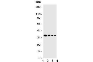 Western blot testing of GCN2 antbody;  Lane 1: Recombinant mouse protein 10ng;  2: 5ng;  3: 2. (GCN2 anticorps  (Middle Region))