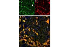 Multiplex staining of NK1 Receptor and mGluR5 in rat DRG - Immunohistochemical staining of rat dorsal root ganglion using Anti-Neurokinin 1 Receptor (NK1R) (extracellular)-ATTO Fluor-488 Antibody (ABIN7043804), (green), (1:60) and Anti-mGluR5 (extracellular)-ATTO Fluor-594 Antibody (ABIN7043251), (red), (1:60).