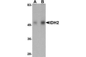 Western blot analysis of IDH2 in human heart tissue lysate with IDH2 antibody at (A) 1 and (B) 2 μg/ml. (IDH2 anticorps  (N-Term))