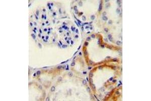 Immunohistochemistry analysis in formalin fixed and paraffin embedded human kidney tissue reacted with HYAL2 Antibody (C-term) followed which was peroxidase conjugated to the secondary antibody and followed by DAB staining.
