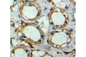 Used in DAB staining on fromalin fixed paraffin-embedded Kidney tissue (Neuregulin 2 anticorps  (AA 101-211))