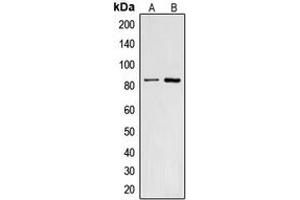 Western blot analysis of CNGA2 expression in HepG2 (A), A431 (B) whole cell lysates. (CNGA2 anticorps  (Center))