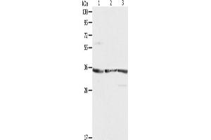 Western Blotting (WB) image for anti-Ribosomal Protein, Large, P0 (RPLP0) antibody (ABIN2422123) (RPLP0 anticorps)