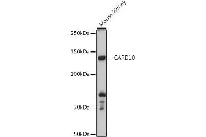 Western blot analysis of extracts of Mouse kidney, using C antibody (ABIN6127549, ABIN6137937, ABIN6137938 and ABIN6223226) at 1:500 dilution. (CARD10 anticorps  (AA 863-1032))