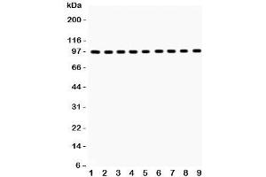 Western blot testing of GR antibody and Lane 1:  rat liver;  2: (r) brain;  3: (r) spleen;  4: human placenta;  5: (h) SMMC;  6: mouse HEPA;  7: (m) Neuro-2a;  8: (h) HeLa;  9: (r) PC12;  Predicted/Observed size: 91~94KD (GR (AA 20-199) anticorps)