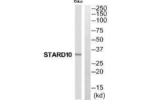 Western blot analysis of extracts from NIH-3T3 cells, using DUSP10 antibody. (DUSP10 anticorps  (C-Term))