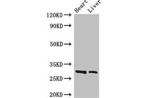 Western Blot Positive WB detected in: Mouse heart tissue, Mouse liver tissue All lanes: SPIC antibody at 3. (SPIC anticorps  (AA 1-248))