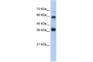 WB Suggested Anti-NRF1 Antibody Titration:  0. (NRF1 anticorps  (N-Term))