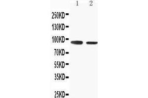 Anti-SLC9A2 antibody, Western blotting Lane 1: Rat Skeletal Musle Tissue Lysate Lane 2: Rat Kidney Tissue Lysate (SLC9A2 anticorps  (C-Term))