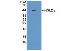 Detection of Recombinant ACTg1, Human using Polyclonal Antibody to Gamma Actin (ACTG) (Actin, gamma 1 anticorps  (AA 1-375))