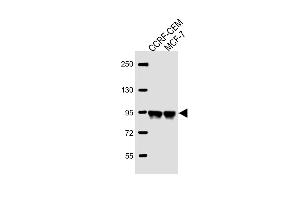All lanes : Anti-AFTPH Antibody (C-term) at 1:2000 dilution Lane 1: CCRF-CEM whole cell lysate Lane 2: MCF-7 whole cell lysate Lysates/proteins at 20 μg per lane. (Aftiphilin anticorps  (C-Term))