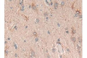 Detection of C6 in Human Brain Tissue using Polyclonal Antibody to Complement Component 6 (C6)