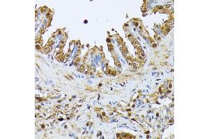 Immunohistochemistry of paraffin-embedded rat lung using SMN1 antibody (ABIN7270652) at dilution of 1:100 (40x lens).