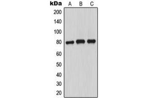 Western blot analysis of MARCKS (pS163) expression in MCF7 PMA-treated (A), SP2/0 PMA-treated (B), PC12 PMA-treated (C) whole cell lysates.