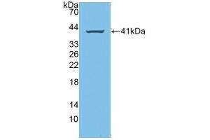 WB of Protein Standard: different control antibodies against Highly purified E. (Amphiregulin Kit CLIA)
