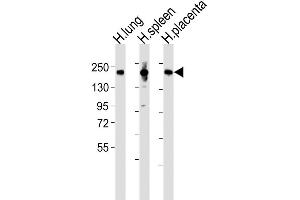Western Blot at 1:2000 dilution Lane 1: human lung lysates Lane 2: human spleen lysates Lane 3: human placenta lysates Lysates/proteins at 20 ug per lane.