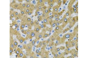 Immunohistochemistry of paraffin-embedded Human liver damage using SDC4 Polyclonal Antibody at dilution of 1:100 (40x lens). (SDC4 anticorps)