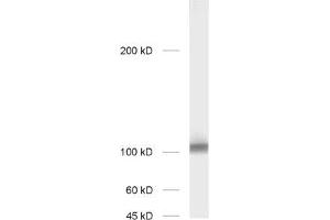 dilution: 1 : 1000; sample: rat hippocampus homogenate (GRIA2 anticorps  (AA 278-292))