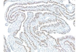 Immunohistochemistry (IHC) image for anti-Paired Box 8 (PAX8) antibody (ABIN7795602) (PAX8 anticorps)