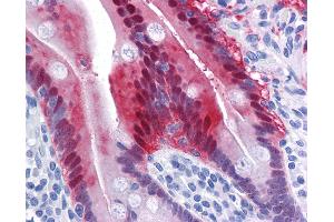 Anti-AKR1B10 antibody IHC of human small intestine.