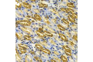 Immunohistochemistry of paraffin-embedded rat kidney using TCP1 antibody at dilution of 1:100 (x400 lens). (TCP1 alpha/CCTA anticorps)
