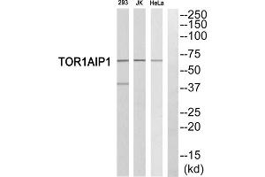 Western blot analysis of extracts from 293 cells, Jurkat cells and HeLa cells, using TOR1AIP1 antibody. (TOR1AIP1 anticorps  (Internal Region))