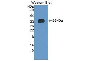 Western Blot; Sample: Recombinant protein. (ENPP2 anticorps  (AA 637-905))