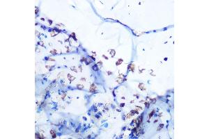 Immunohistochemistry of paraffin-embedded mouse bone marrow using ALDOA Rabbit mAb (ABIN7265550) at dilution of 1:100 (40x lens). (ALDOA anticorps)