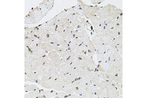 Immunohistochemistry of paraffin-embedded mouse heart using GTF2H2 antibody (ABIN5975366) at dilution of 1/100 (40x lens). (GTF2H2 anticorps)