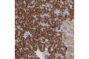 Immunohistochemical staining of human pancreas with UFL1 polyclonal antibody  shows strong cytoplasmic positivity in exocrine glandular cells at 1:50-1:200 dilution. (UFL1 anticorps)