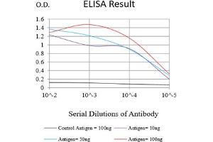 Black line: Control Antigen (100 ng),Purple line: Antigen (10 ng), Blue line: Antigen (50 ng), Red line:Antigen (100 ng)