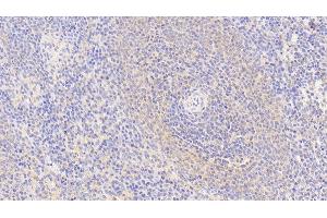 Detection of S100Z in Human Spleen Tissue using Polyclonal Antibody to S100 Calcium Binding Protein Z (S100Z) (S100Z anticorps  (AA 1-99))