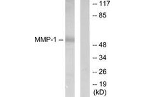 Western Blotting (WB) image for anti-Matrix Metallopeptidase 1 (Interstitial Collagenase) (MMP1) (AA 411-460) antibody (ABIN2889225) (MMP1 anticorps  (AA 411-460))